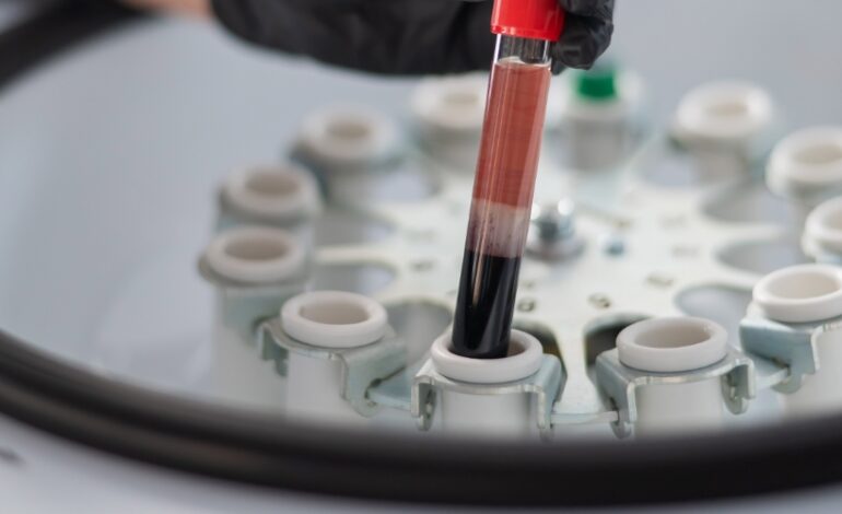 Un grand pas en avant grâce aux biomarqueurs